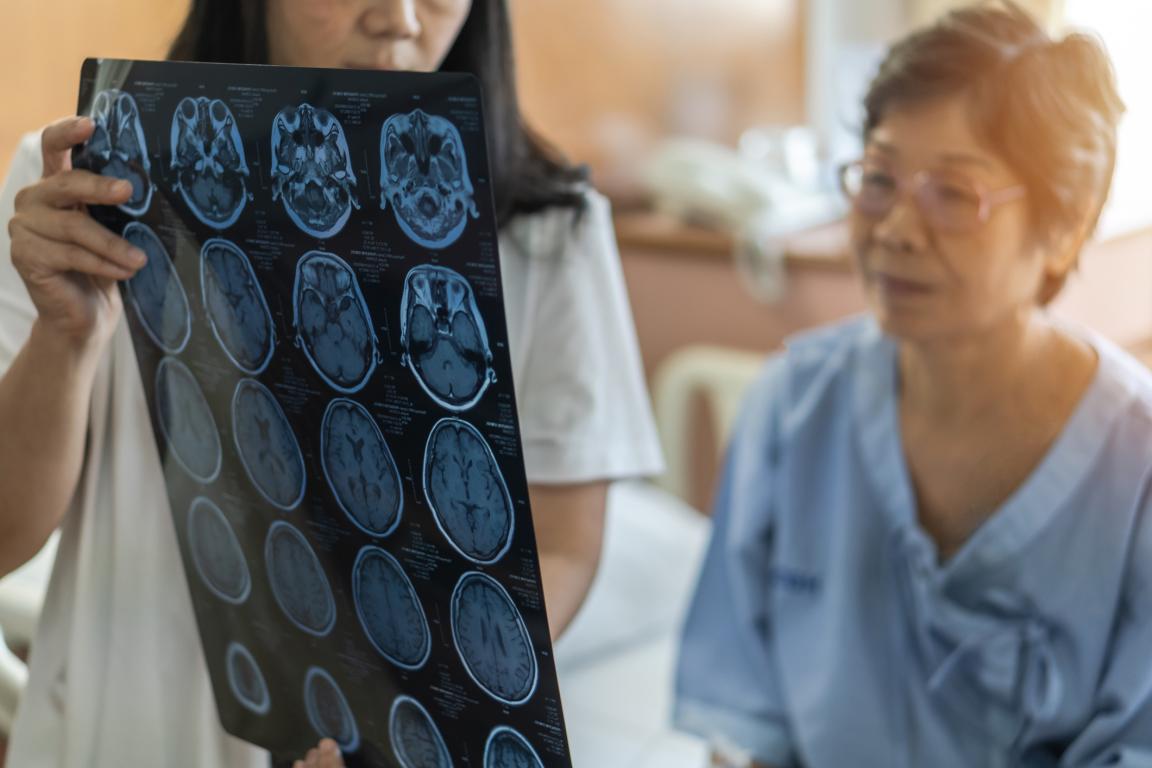 Older woman reviewing brain charts with doctor